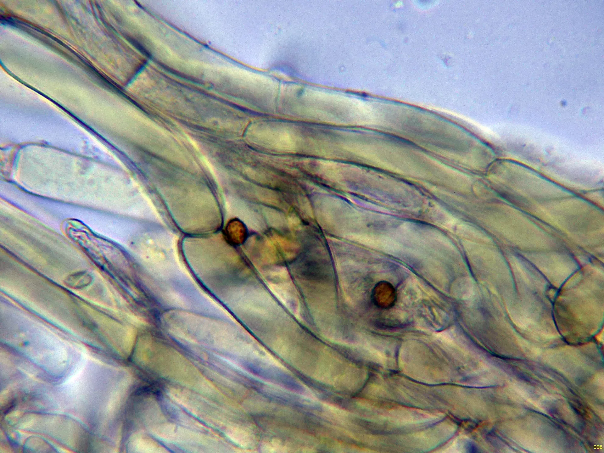 10 - Suprapellis agua-006